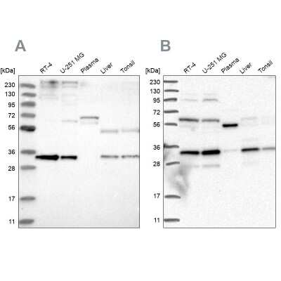 Western Blot: Phosphopantothenate-cysteine ligase Antibody [NBP1-87398] - Analysis using Anti-PPCS antibody NBP1-87398 (A) shows similar pattern to independent antibody NBP2-38181 (B).