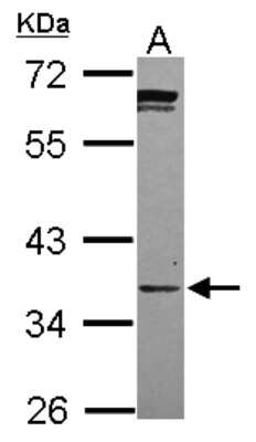 Western Blot: Phosphopantothenate-cysteine ligase Antibody [NBP2-19811] - Sample (30 ug of whole cell lysate) A: 293T 10% SDS PAGE gel, diluted at 1:1000.