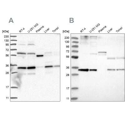 Western Blot: Phosphopantothenate-cysteine ligase Antibody [NBP2-38181] - Analysis using Anti-PPCS antibody NBP2-38181 (A) shows similar pattern to independent antibody NBP1-87398 (B).