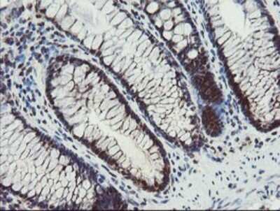 Immunohistochemistry: Phosphoribosyl Pyrophosphate Amidotransferase Antibody (1B11) [NBP2-45379] - Analysis of Human colon tissue (Heat-induced epitope retrieval by 10mM citric buffer, pH6.0, 120C for 3min)