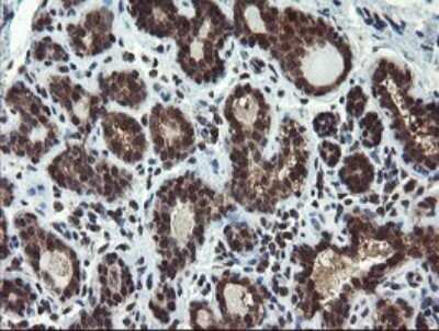 Immunohistochemistry: Phosphoribosyl Pyrophosphate Amidotransferase Antibody (1B11) [NBP2-45379] - Analysis of Human breast tissue. (Heat-induced epitope retrieval by 10mM citric buffer, pH6.0, 120C for 3min)