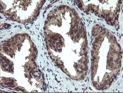 Immunohistochemistry: Phosphoribosyl Pyrophosphate Amidotransferase Antibody (1B11) [NBP2-45379] - Analysis of Human prostate tissue. (Heat-induced epitope retrieval by 10mM citric buffer, pH6.0, 120C for 3min)
