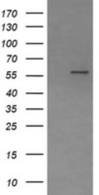 Western Blot Phosphoribosyl Pyrophosphate Amidotransferase Antibody (OTI1B11)