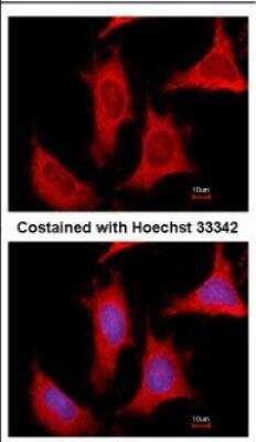 Immunocytochemistry/Immunofluorescence: Phosphoribosyl Pyrophosphate Amidotransferase Antibody [NBP2-19812] - Immunofluorescence analysis of methanol-fixed HeLa, using antibody at 1:500 dilution.