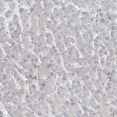 Immunohistochemistry-Paraffin: Phosphoribosyl Pyrophosphate Amidotransferase Antibody [NBP1-89744] - Staining of human liver shows no cytoplasmic positivity in hepatocytes as expected.