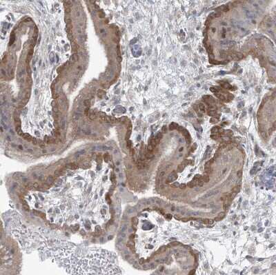 Immunohistochemistry-Paraffin: Phosphoribosyl Pyrophosphate Amidotransferase Antibody [NBP1-89744] - Staining of human placenta shows moderate cytoplasmic positivity in trophoblastic cells.