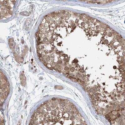 Immunohistochemistry-Paraffin: Phosphoribosyl Pyrophosphate Amidotransferase Antibody [NBP2-38279] - Staining of human testis shows moderate cytoplasmic positivity in cells in seminiferous ducts.