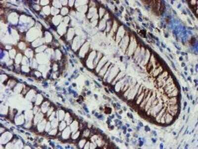 Immunohistochemistry: Phosphoribosyl Pyrophosphate Amidotransferase Antibody (OTI1B8) - Azide and BSA Free [NBP2-73394] - Staining of paraffin-embedded Human colon tissue using anti-Phosphoribosyl Pyrophosphate Amidotransferase mouse monoclonal antibody.