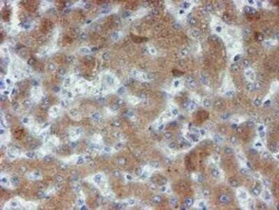 Immunohistochemistry: Phosphoribosyl Pyrophosphate Amidotransferase Antibody (OTI1B8) - Azide and BSA Free [NBP2-73394] - Staining of paraffin-embedded Human liver tissue using anti-Phosphoribosyl Pyrophosphate Amidotransferase mouse monoclonal antibody.