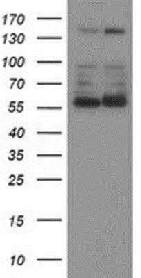 Western Blot: Phosphoribosyl Pyrophosphate Amidotransferase Antibody (OTI1B8) - Azide and BSA Free [NBP2-73394] - HEK293T cells were transfected with the pCMV6-ENTRY control (Left lane) or pCMV6-ENTRY Phosphoribosyl Pyrophosphate Amidotransferase (Right lane) cDNA for 48 hrs and lysed. Equivalent amounts of cell lysates (5 ug per lane) were separated by SDS-PAGE and
