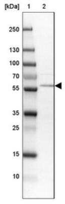Western Blot Phosphoribosyl Pyrophosphate Amidotransferase Antibody - BSA Free