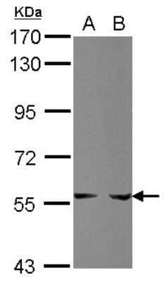 Western Blot: Phosphoribosyl Pyrophosphate Amidotransferase Antibody [NBP2-19812] - Sample (30 ug of whole cell lysate)  A: HepG2  B: HCT116  7.5% SDS PAGE  diluted at 1:1000