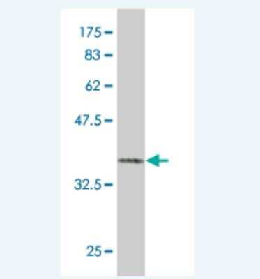 Western Blot: Phosphorylase B Antibody (2E9.) [H00005257-M02] - Detection against Immunogen (37.84 KDa) .