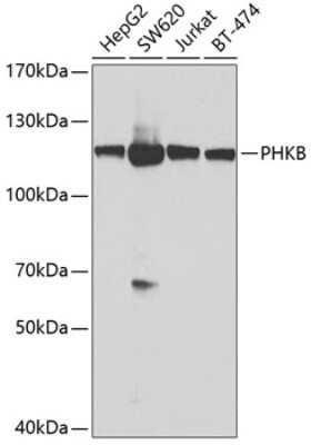 Western Blot: Phosphorylase B Antibody [NBP2-93725] - Analysis of extracts of various cell lines, using Phosphorylase B at 1:1000 dilution. Secondary antibody: HRP Goat Anti-Rabbit IgG (H+L) at 1:10000 dilution. Lysates/proteins: 25ug per lane. Blocking buffer: 3% nonfat dry milk in TBST. Detection: ECL Basic Kit . Exposure time: 5s.