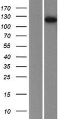 Western Blot: Phosphorylase B Overexpression Lysate (Adult Normal) [NBP2-10607] Left-Empty vector transfected control cell lysate (HEK293 cell lysate); Right -Over-expression Lysate for Phosphorylase B.