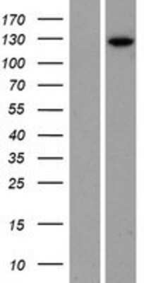 Western Blot: Phosphorylase B Overexpression Lysate (Adult Normal) [NBP2-11145] Left-Empty vector transfected control cell lysate (HEK293 cell lysate); Right -Over-expression Lysate for Phosphorylase B.