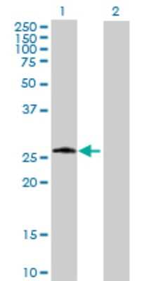 Western Blot: Phosphoserine phosphatase Antibody [H00005723-B01P] - Analysis of PSPH expression in transfected 293T cell line by PSPH polyclonal antibody.  Lane 1: PSPH transfected lysate(24.75 KDa). Lane 2: Non-transfected lysate.