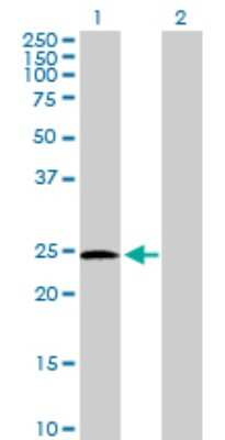 Western Blot: Phosphoserine phosphatase Antibody [H00005723-D01P] - Analysis of PSPH expression in transfected 293T cell line by PSPH polyclonal antibody.Lane 1: PSPH transfected lysate(25.00 KDa).Lane 2: Non-transfected lysate.