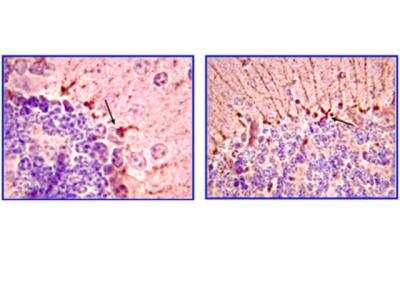 Immunohistochemistry: Piccolo Antibody (4G3.3) [NBP2-29749] - Immunohistochemistry (Paraffin): Representative images from a previous lot. Piccolo staining pattern/morphology on mouse brain tissue/cerebellum. Tissue was pretreated with citrate pH 6.0, antigen retrieval. A previous lot of the antibody was diluted to 1:300, using IHC-Select Detection with HRP-DAB. Immunoreactivity is localized to the synaptic junction of neurons in the granular layer and Purkinje cells(arrow).