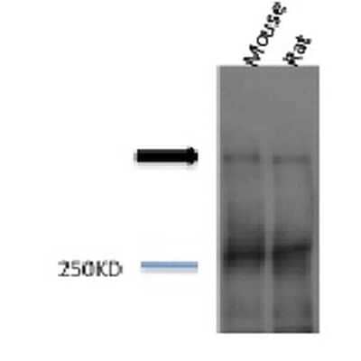 Western Blot: Piccolo Antibody [NBP1-54407] - Western blot analysis of Mouse, Rat brain cell lysates showing detection of Piccolo protein using Rabbit Anti-Piccolo Polyclonal Antibody (NBP1-54407). Primary Antibody: Rabbit Anti-Piccolo Polyclonal Antibody (NBP1-54407) at 1:1000.