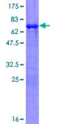 SDS-Page: Piccolo Recombinant Protein [H00027445-P01]