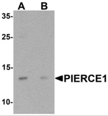 Western Blot: Pierce-1 Antibody [NBP2-81981] - Analysis of Pierce-1 in A20 cell lysate with Pierce-1 antibody at 1 ug/ml in the (A) absence and (B) presence of blocking peptide.