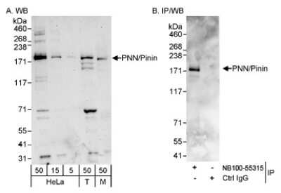 Western Blot: Pinin Antibody [NB100-55315] - Detection of Human and Mouse PNN/Pininon HeLa whole cell lysate using NB100-55315.