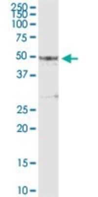 Western Blot: Pipecolic acid oxidase Antibody [H00051268-D01P] - Analysis of PIPOX expression in human placenta.