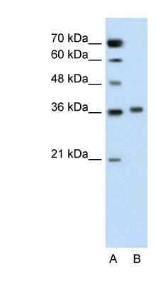 Western Blot: Pipecolic acid oxidase Antibody [NBP1-60060] - Jurkat cell lysate, concentration 0.2-1 ug/ml.