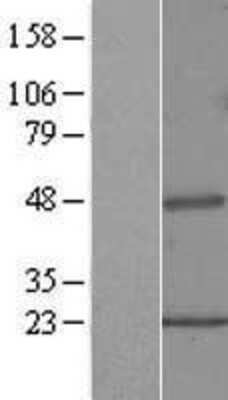 Western Blot: Pipecolic acid oxidase Overexpression Lysate (Adult Normal) [NBL1-14438] Left-Empty vector transfected control cell lysate (HEK293 cell lysate); Right -Over-expression Lysate for Pipecolic acid oxidase.