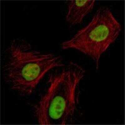 Immunocytochemistry/Immunofluorescence: Pirh2 Antibody (1H10) [NBP1-51604] - Immunofluorescence analysis of Hela cells using Pirh2 mouse mAb (green). Red: Actin filaments have been labeled with Alexa Fluor-555 phalloidin.