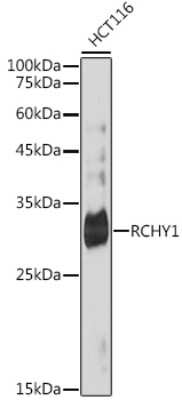 Western Blot: Pirh2 Antibody (4Q5H9) [NBP3-15743] - Western blot analysis of extracts of HCT116 cells, using Pirh2 antibody (NBP3-15743) at 1:1000 dilution. Secondary antibody: HRP Goat Anti-Rabbit IgG (H+L) at 1:10000 dilution. Lysates/proteins: 25ug per lane. Blocking buffer: 3% nonfat dry milk in TBST. Detection: ECL Basic Kit. Exposure time: 180s.