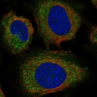 Immunocytochemistry/Immunofluorescence: Pirh2 Antibody [NBP3-17291] - Staining of human cell line U-2 OS shows localization to cytosol & vesicles.