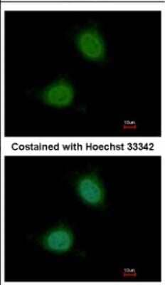 Immunocytochemistry/ Immunofluorescence Pirin Antibody