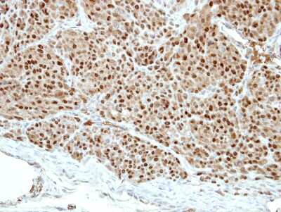 Immunohistochemistry-Paraffin Pirin Antibody