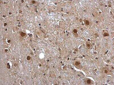 Immunohistochemistry-Paraffin: Pirin Antibody [NBP2-19840] - Paraffin-embedded rat brain stem. Pirin antibody  dilution: 1:500.