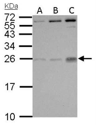 Western Blot: PlGF Antibody [NBP1-32169] - Antibody detects PGF protein by Western blot analysis; antibody dilution 1:500.