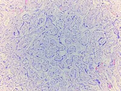 Unknown Placenta Tissue Slides (Adult Normal)- Paraffin