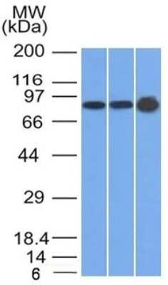 Western Blot: Plakophilin 1 Antibody (10B2) - Azide and BSA Free [NBP2-54526] - Western Blot of U87, HeLa and A431 cell lysates using Plakophilin 1 Antibody (10B2)