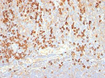 Immunohistochemistry-Paraffin: Plasma Cell Marker Antibody (SPM310) - Azide and BSA Free [NBP2-34407] - Formalin-paraffin human tonsil stained with Plasma Cell Marker MAb (SPM310).