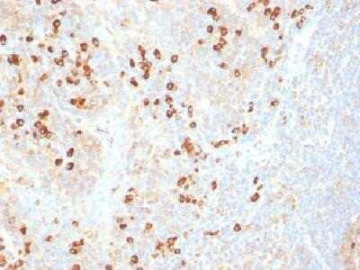 Immunohistochemistry-Paraffin: Plasma Cell Marker Antibody (SPM310) - Azide and BSA Free [NBP2-34407] - Formalin-fixed paraffin-embedded human tonsil stained with plasma cell marker Monoclonal antibody (SPM310)
