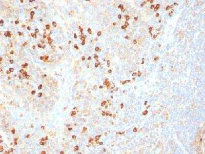 Immunohistochemistry-Paraffin: Plasma Cell Marker Antibody (SPM310) [NBP2-34359] - Formalin-fixed paraffin-embedded human tonsil stained with plasma cell marker Monoclonal antibody (SPM310)