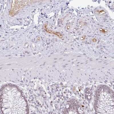 Immunohistochemistry: Plasminogen Antibody [NBP2-48919] - Staining of human colon shows positivity in plasma.