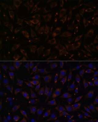 Immunocytochemistry/ Immunofluorescence Plasmolipin Antibody - Azide and BSA Free