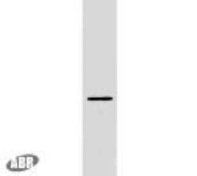 Western Blot: Plasmolipin Antibody [NBP2-22465] - Analysis of plasmolipin from rat kidney extract.