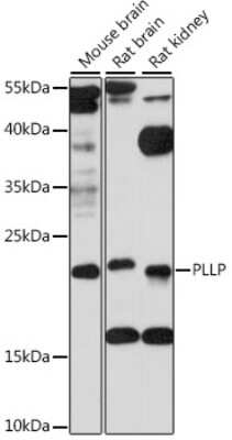 Western Blot Plasmolipin Antibody - Azide and BSA Free