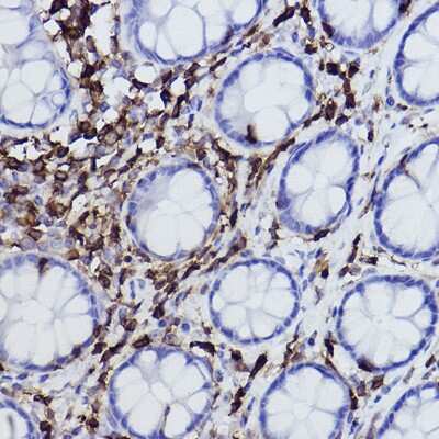 Immunohistochemistry-Paraffin: Plastin L Antibody (3T0M1) [NBP3-16459] - Immunohistochemistry of paraffin-embedded human colon using Plastin L Rabbit mAb (NBP3-16459) at dilution of 1:100 (40x lens).Perform high pressure antigen retrieval with 10 mM citrate buffer pH 6.0 before commencing with IHC staining protocol.