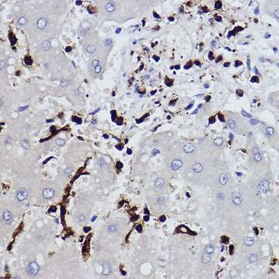 Immunohistochemistry-Paraffin: Plastin L Antibody (3T0M1) [NBP3-16459] - Immunohistochemistry of paraffin-embedded human liver using Plastin L Rabbit mAb (NBP3-16459) at dilution of 1:100 (40x lens).Perform high pressure antigen retrieval with 10 mM citrate buffer pH 6.0 before commencing with IHC staining protocol.