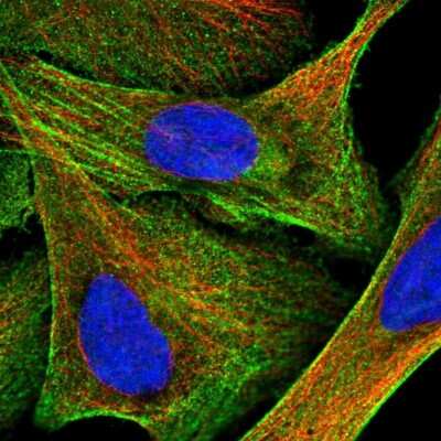 <b>Orthogonal Strategies Validation. </b>Immunocytochemistry/Immunofluorescence: Plastin L Antibody [NBP1-88057] - Staining of human cell line U-2 OS shows localization to plasma membrane, cytosol and actin filaments. Antibody staining is shown in green. 