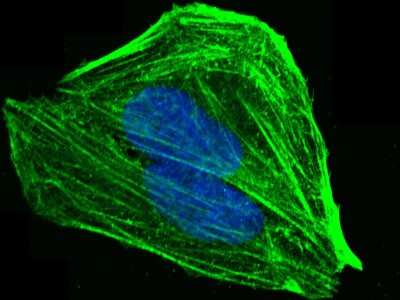 Immunocytochemistry/Immunofluorescence: Plastin L Antibody [NBP2-99366] - Immunofluorescence staining of Plastin L in U2OS cells. Cells were fixed with 4% PFA, permeabilzed with 0.1% Triton X-100 in PBS, blocked with 10% serum, and incubated with rabbit anti-Human Plastin L polyclonal antibody (dilution ratio 1:1000) at 4C overnight. Then cells were stained with the Alexa Fluor(R)488-conjugated Goat Anti-rabbit IgG secondary antibody (green) and counterstained with DAPI (blue).Positive staining was localized to Cytoplasm.